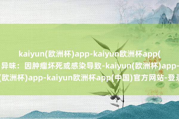 kaiyun(欧洲杯)app-kaiyun欧洲杯app(中国)官方网站-登录入口异味：因肿瘤坏死或感染导致-kaiyun(欧洲杯)app-kaiyun欧洲杯app(中国)官方网站-登录入口